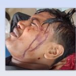 নগরকান্দায় সন্ত্রাসী হামলায় জামায়াতের আমীরের ছেলে আহত